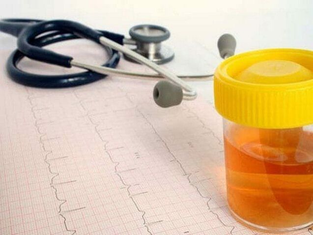 Análise de orina para diagnosticar cistite