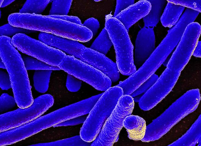 E. coli a miúdo desencadea o desenvolvemento de cistite nas mulleres